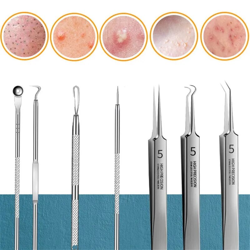 11Pcs/Set Acne Needle Blackhead Clip Remover Extraction Pore Black Head Cleaner Face Skin Care Cleansing Needle Tool Cell Clamp - anydaydirect