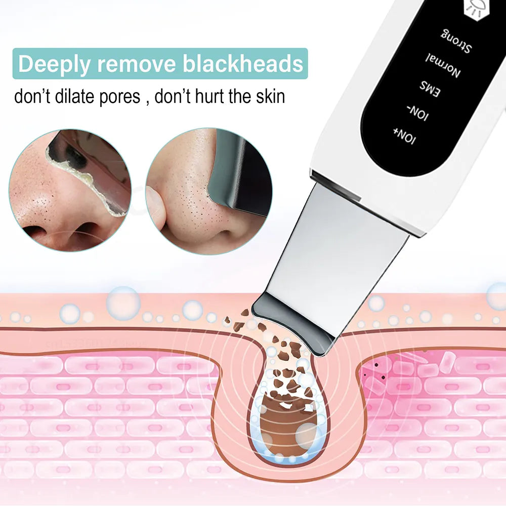 Ultrasonic Skin Scrubber Peeling Blackhead Remover Deep Face Cleaning Ultrasonic Ion Ance Pore Cleaner Facial Shovel Cleanser - anydaydirect