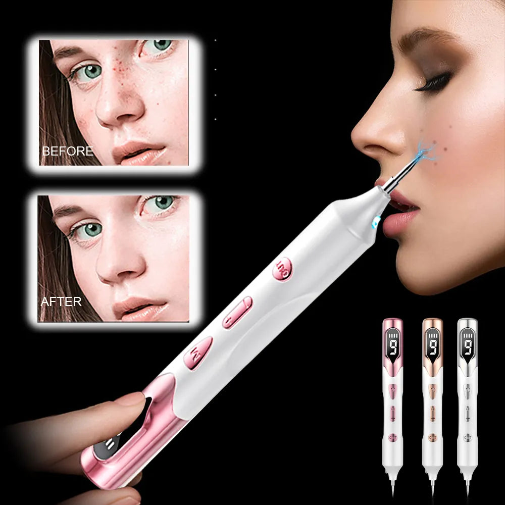 Laser Plasma Pen for Skin Tag Remover Freckle Black Dot Papilloma Warts Mole Pimples Tattoo Removal Laser Pen Beauty Care Tools - anydaydirect