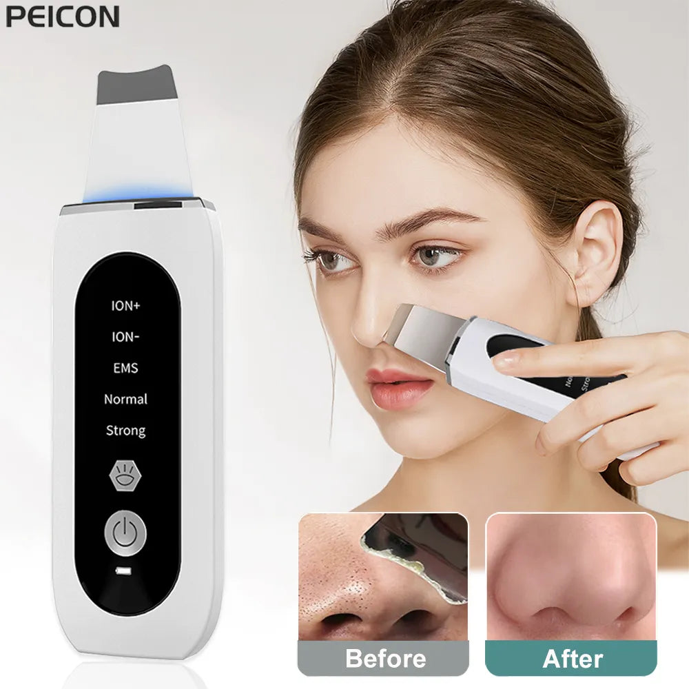 Ultrasonic Skin Scrubber Peeling Blackhead Remover Deep Face Cleaning Ultrasonic Ion Ance Pore Cleaner Facial Shovel Cleanser - anydaydirect